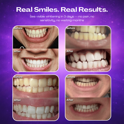 DR.PEARL™ Whitening Strips