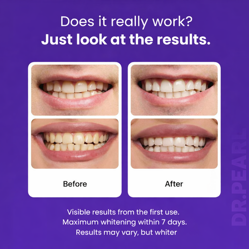 DR.PEARL™ Whitening Strips 3.0