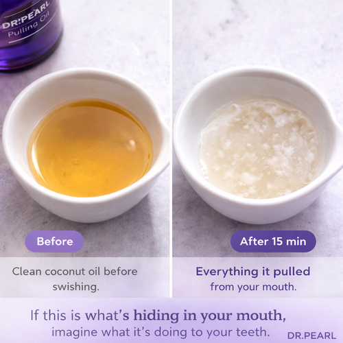 DR.PEARL™ Coconut Pulling Oil