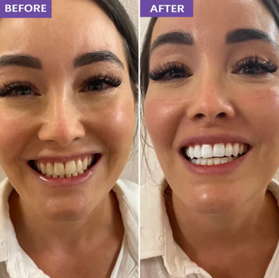 DR.PEARL™ Whitening Strips